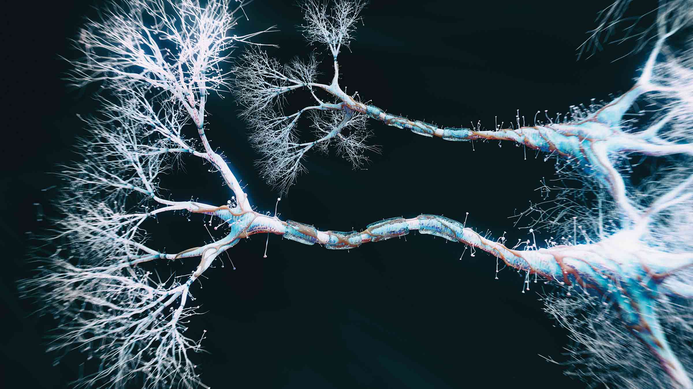 Neural network