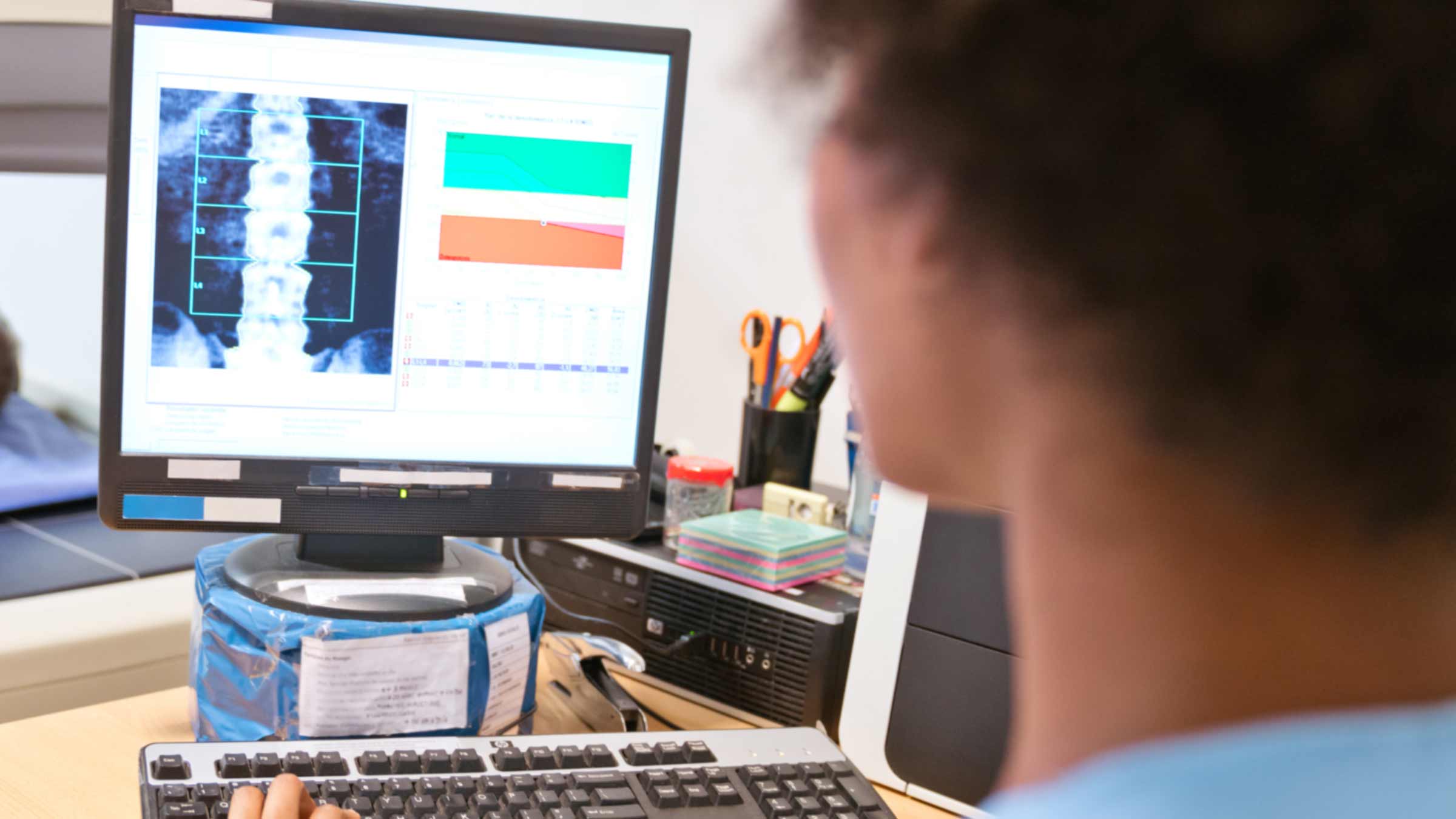 Nurse reviewing spine imaging on computer