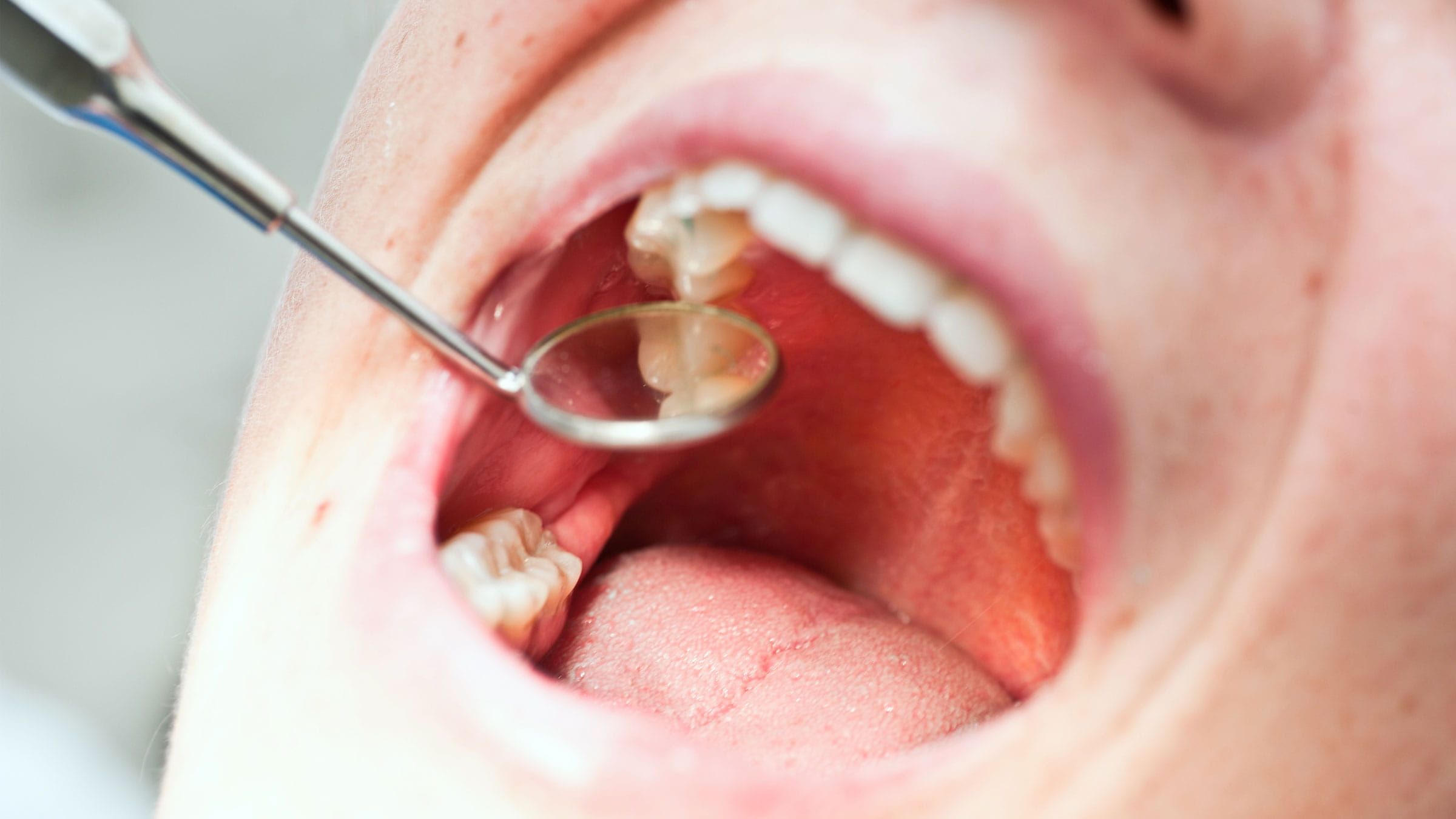 Dental exam of a patient's tongue