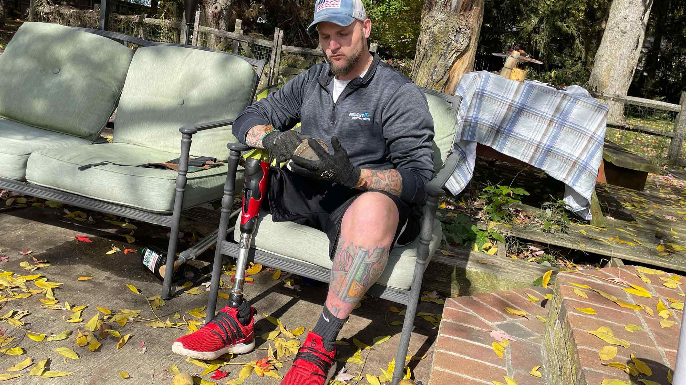 Broc Potts now has an advanced prosthetic that snaps onto a bar that was surgically implanted in this leg at the OSUCCC – James, allowing him to move more freely.