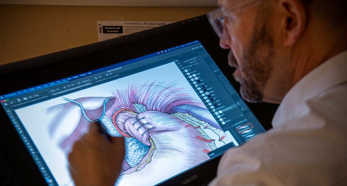 Anthony Baker digital sketching medical illustrations