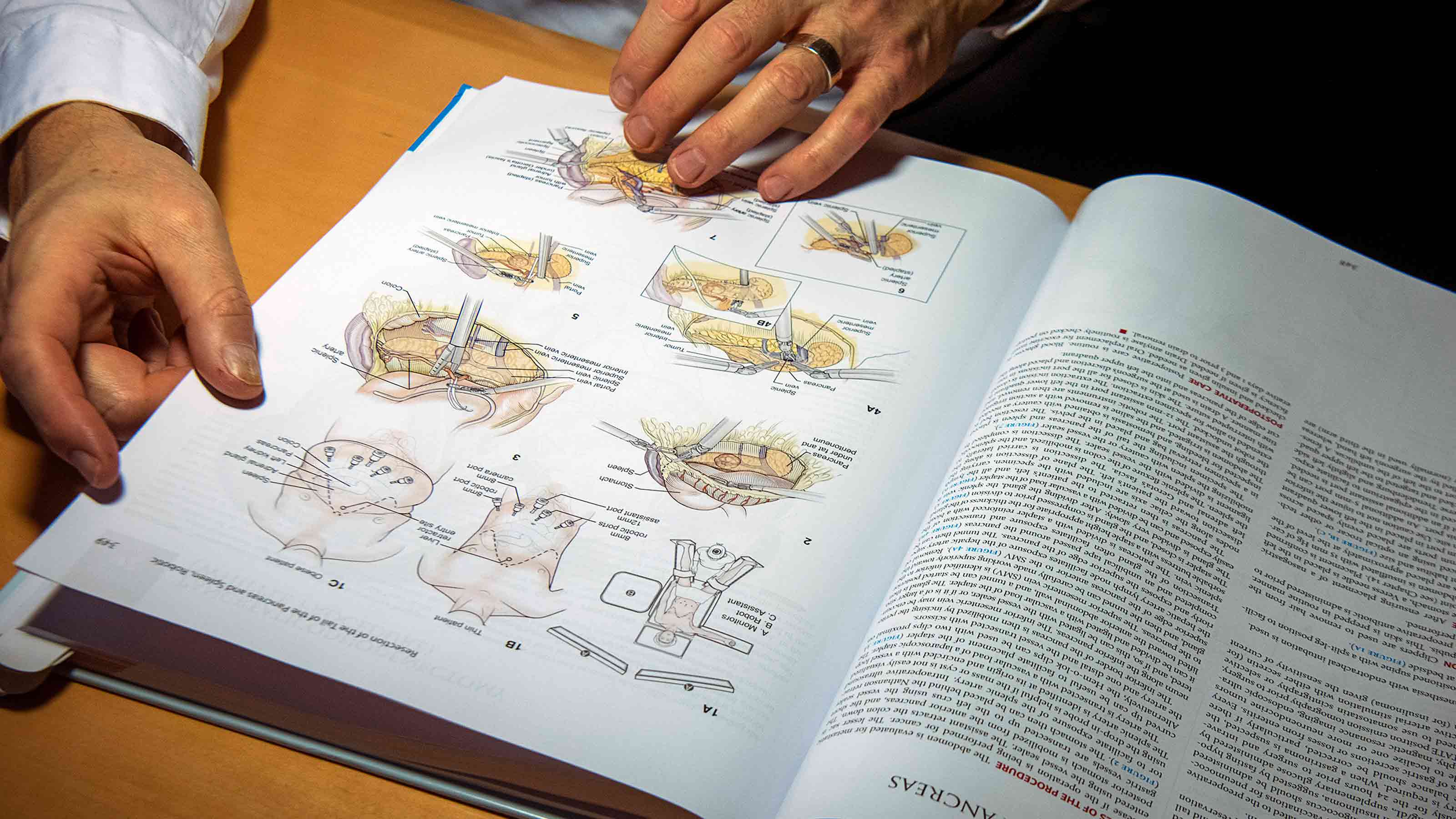 illustrations in the Atlas of Surgical Operations