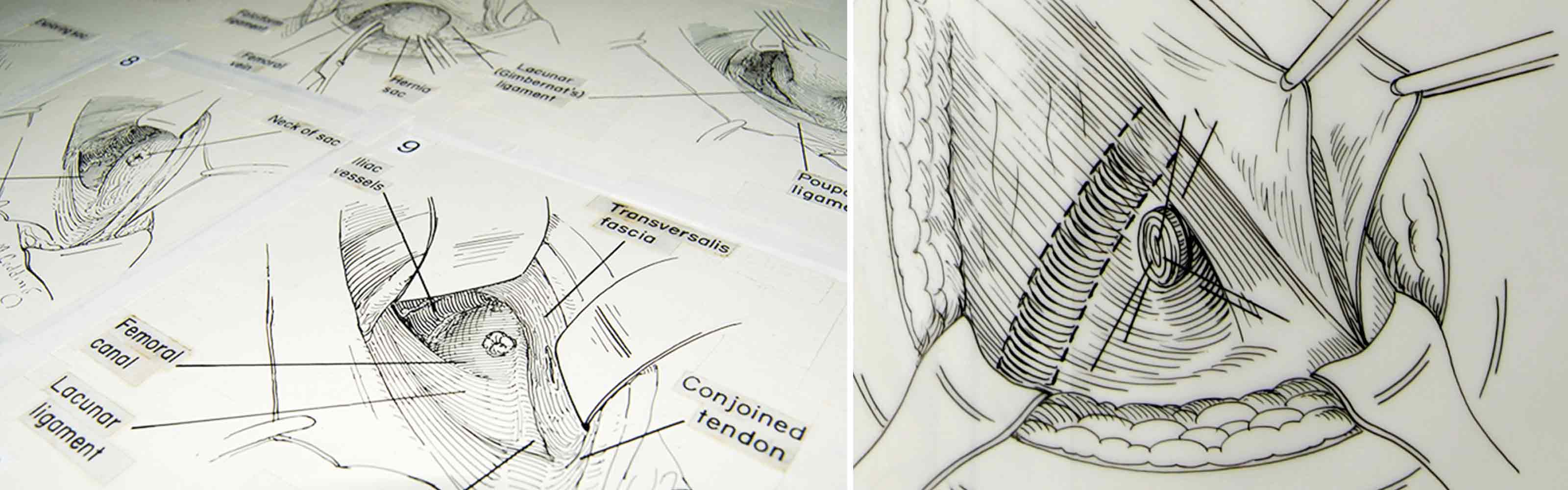 Atlas-of-Surgical-Operations illustrations