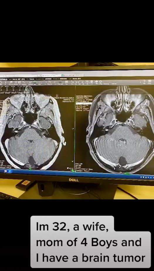Tiktok post showing a brain scan