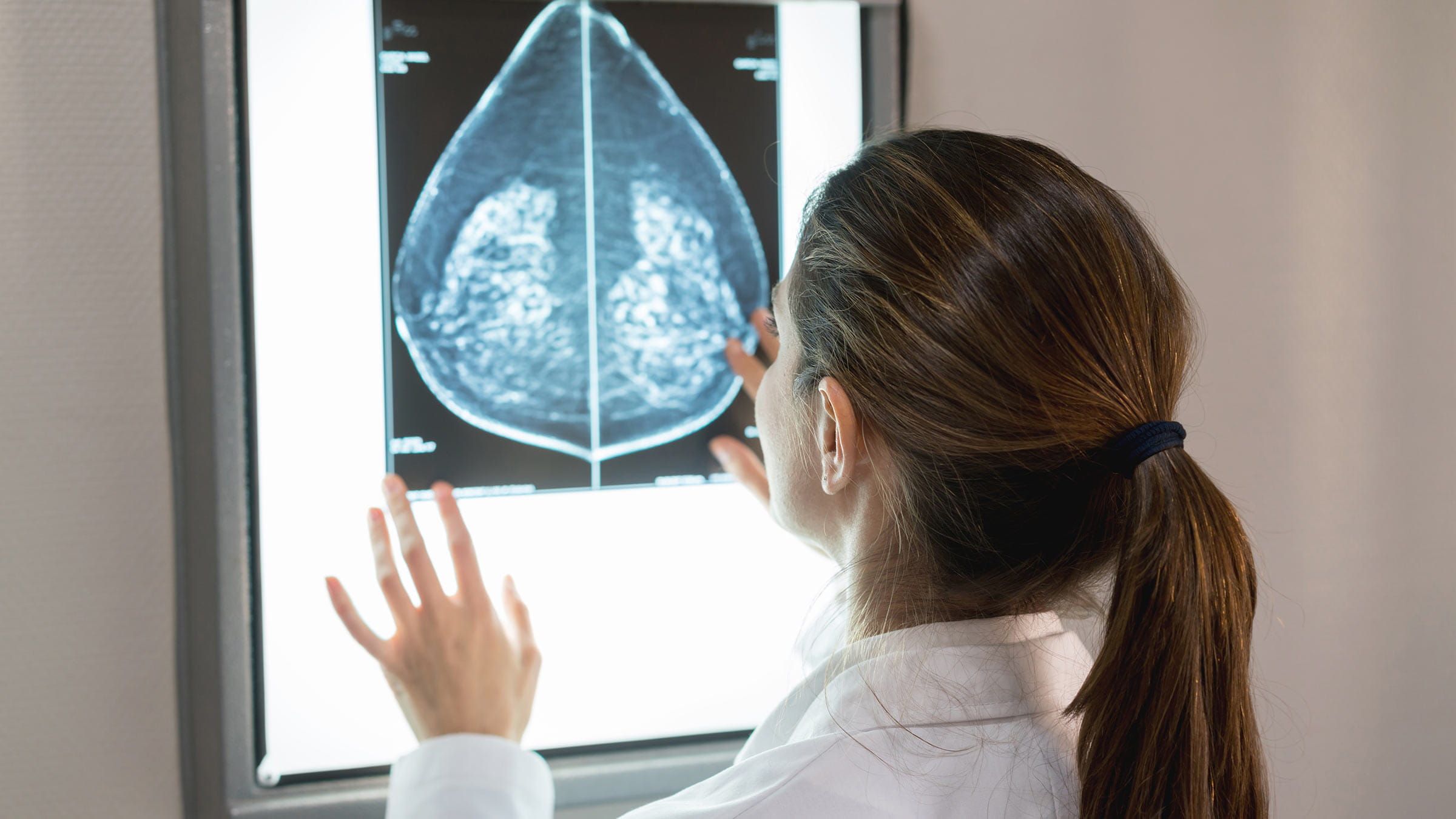 Gynocologist looking at a mammogram at the hospital