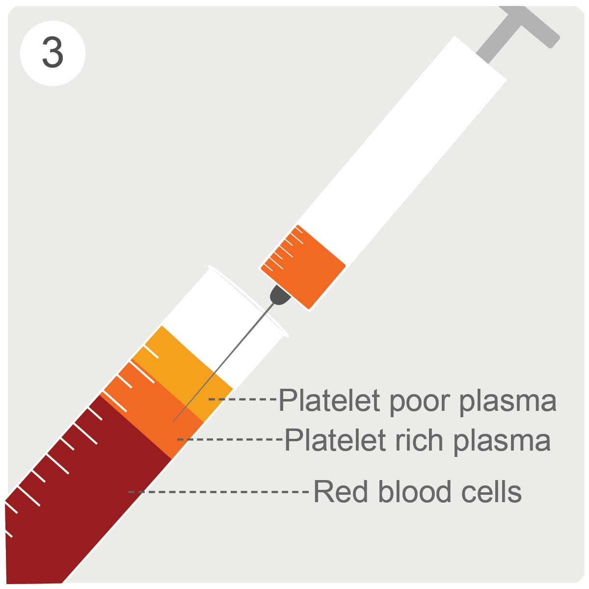 The plasma-rich platelets are drawn