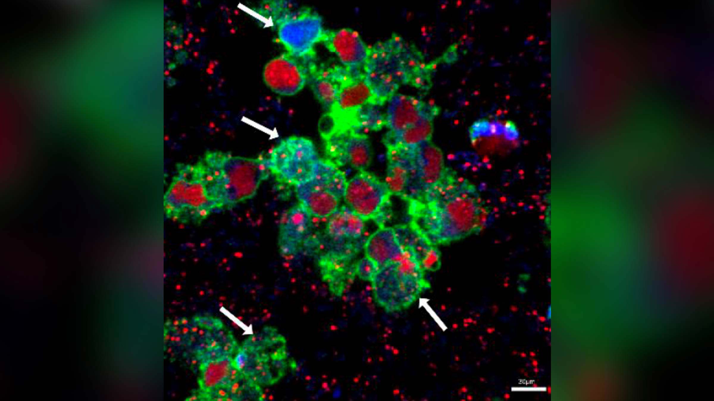 Microimaging of staph infection in white blood cells