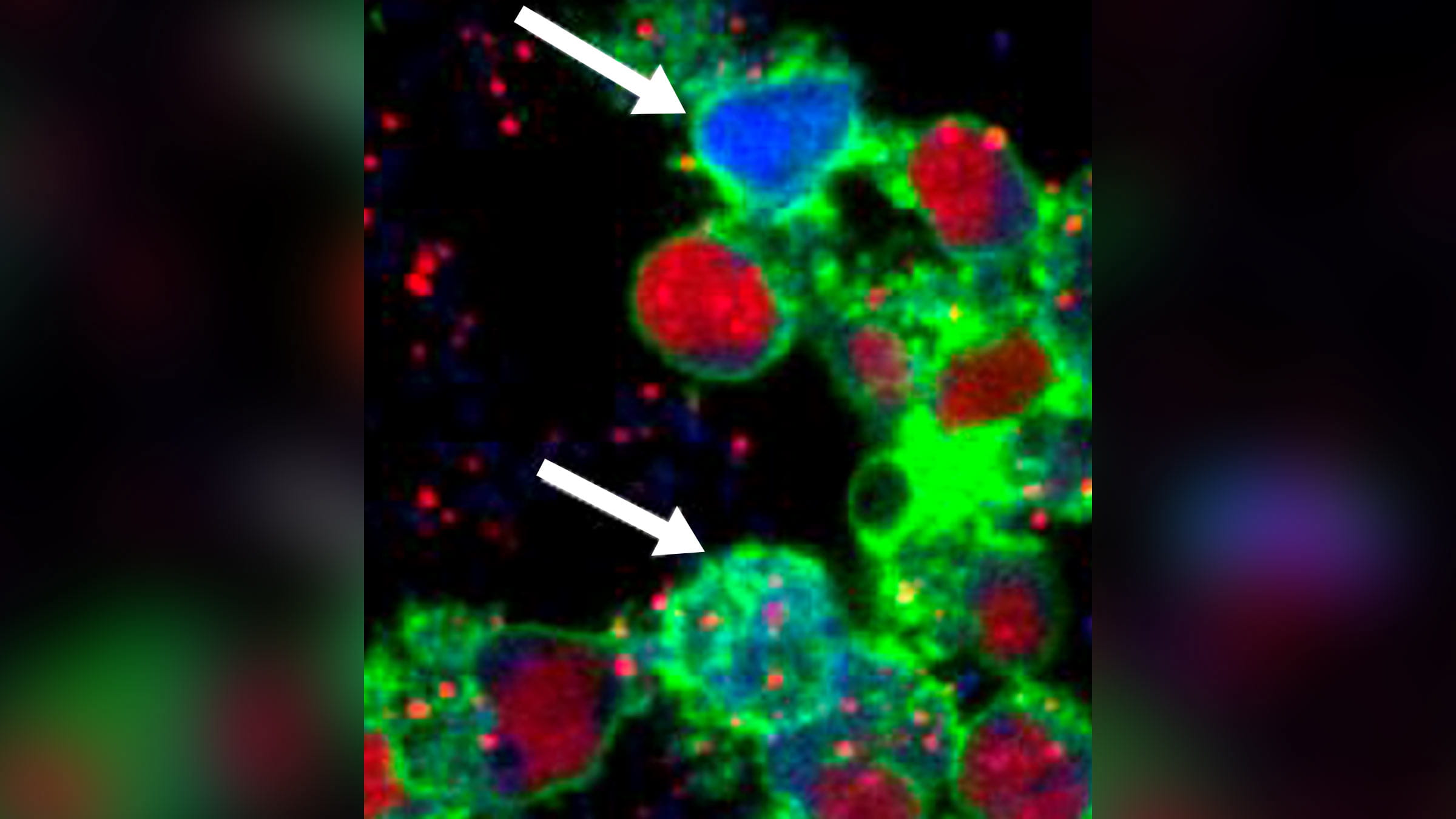 Microimaging of staph infection in white blood cells