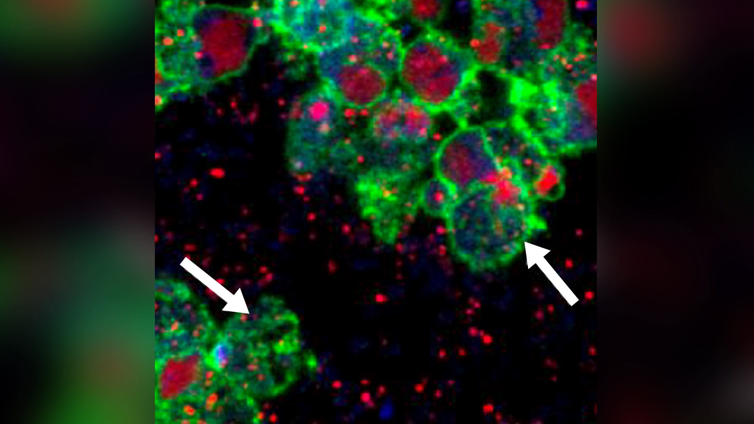 Microimaging of staph infection in white blood cells