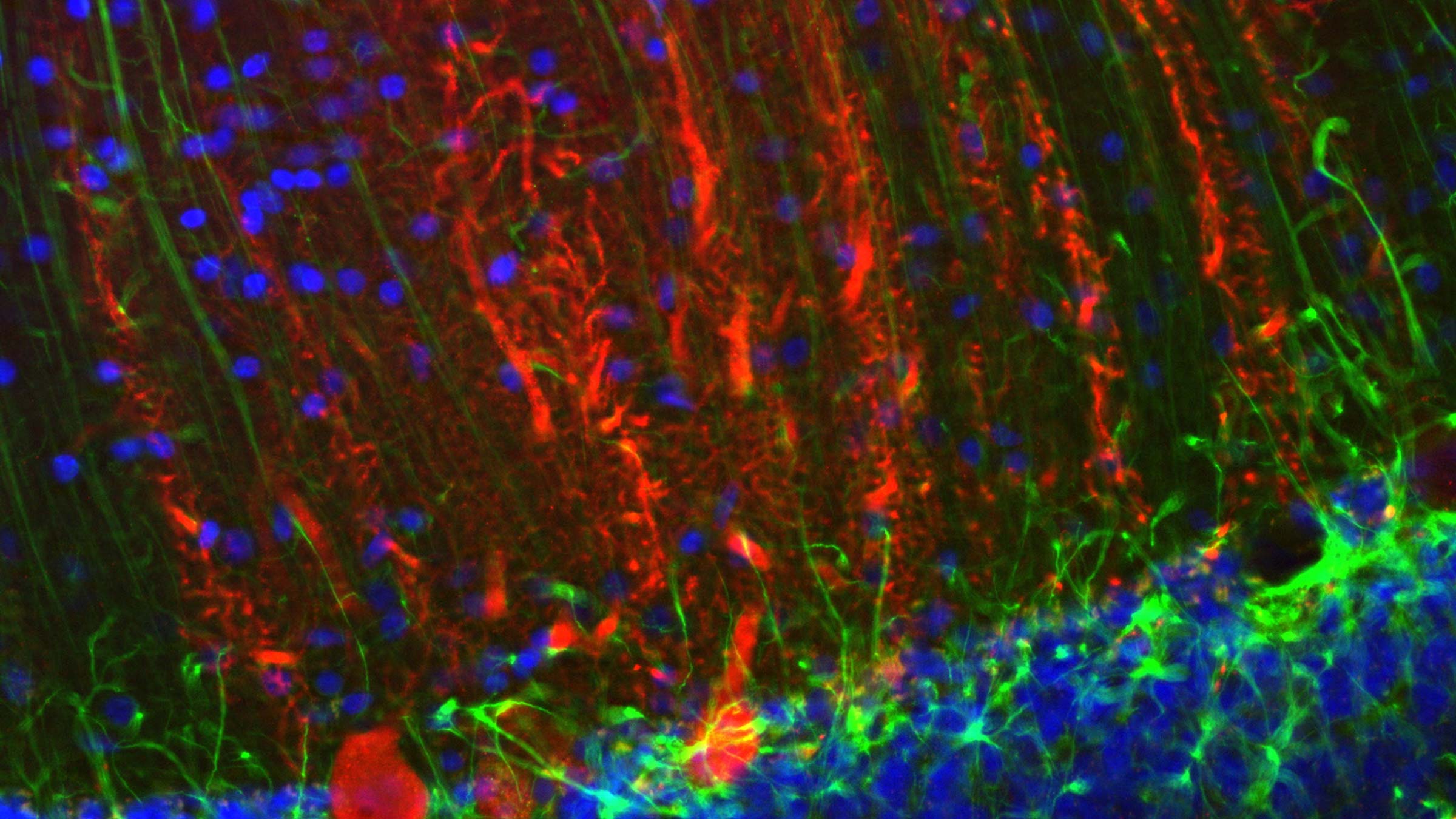 Microimaging of the cerebellar cortex in the brain