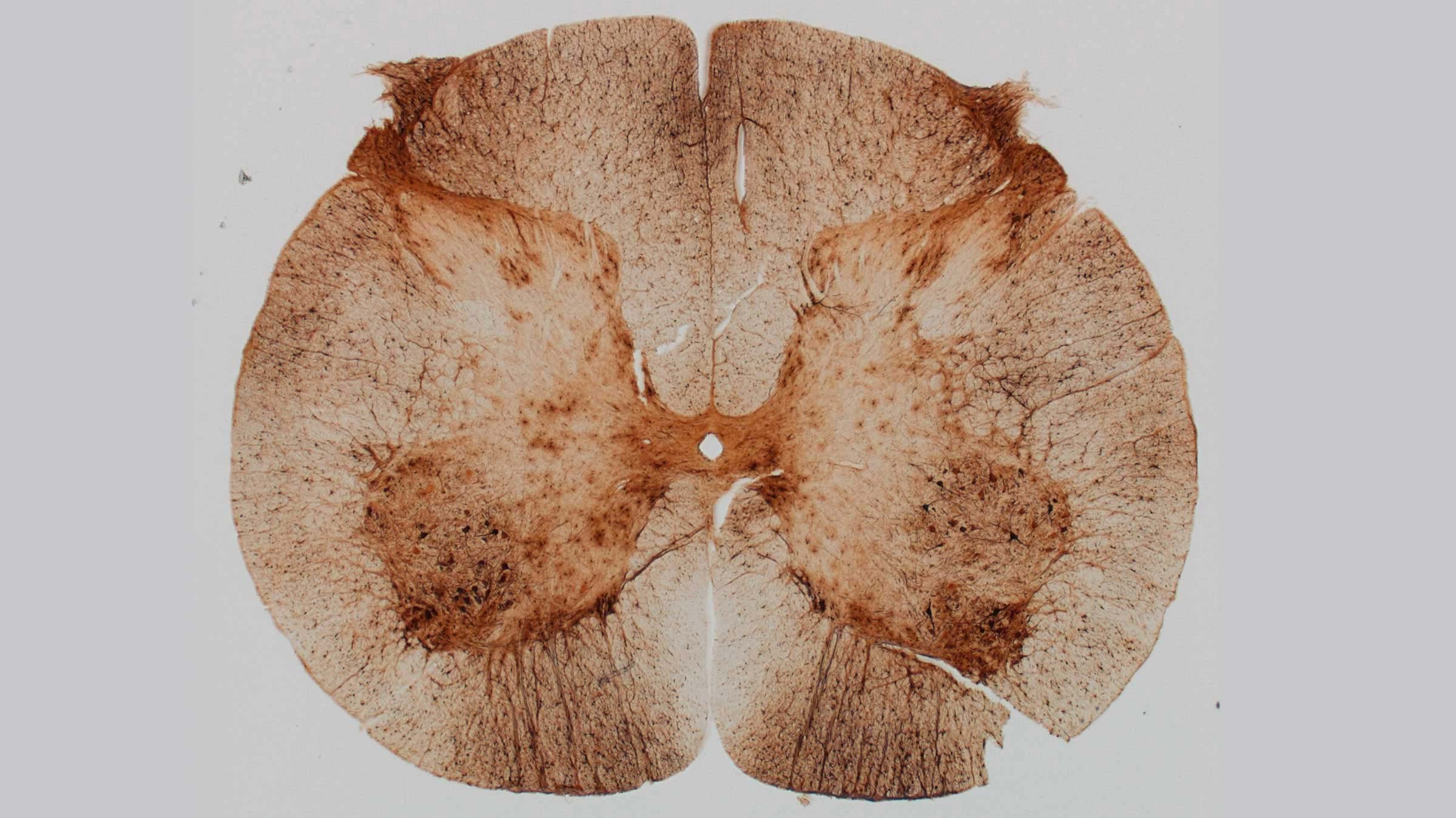 Microimaging of the cross-section of the spinal cord