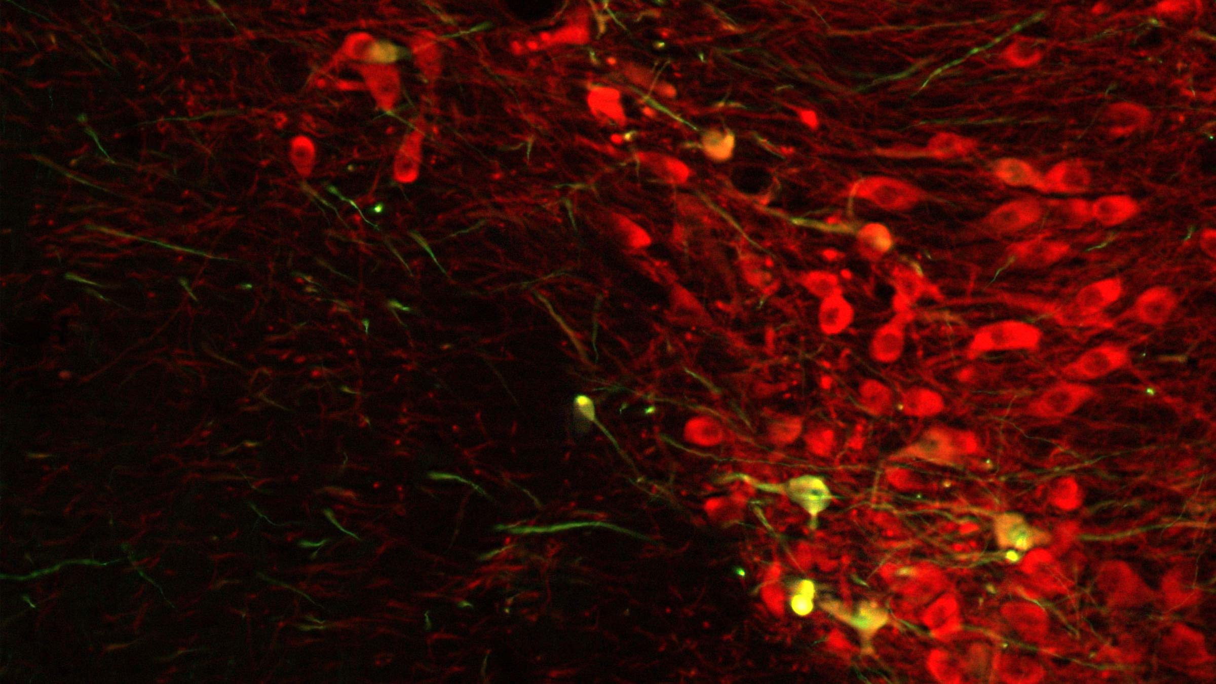 Microimaging of the neurological cells in the brain