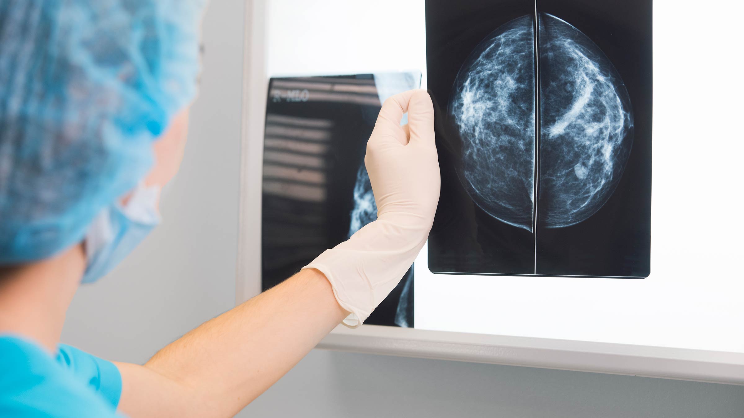 A nurse inspects a patient’s mammogram