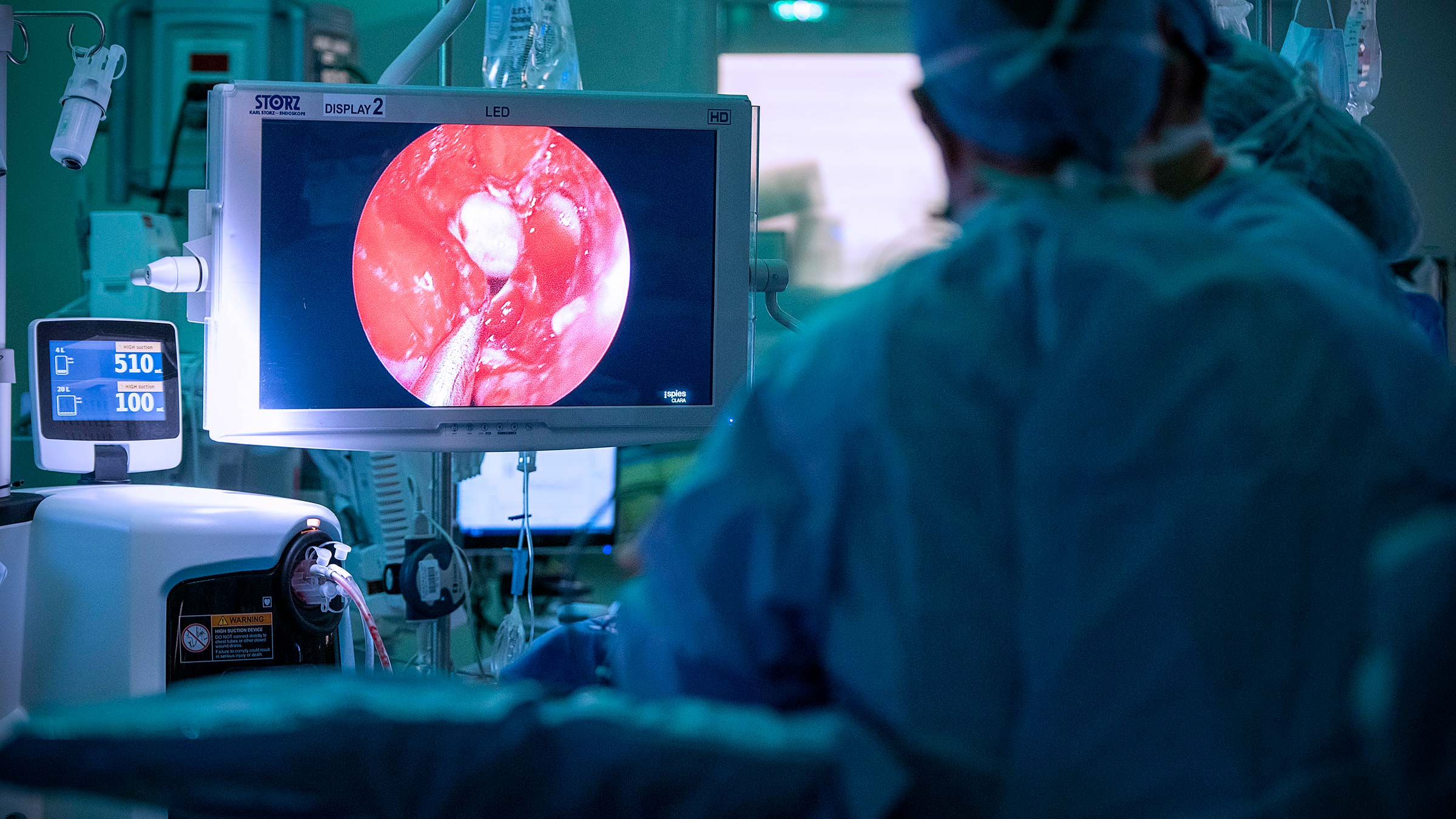 An endoscopic view of Diana Robertson’s endonasal passageway during a procedure