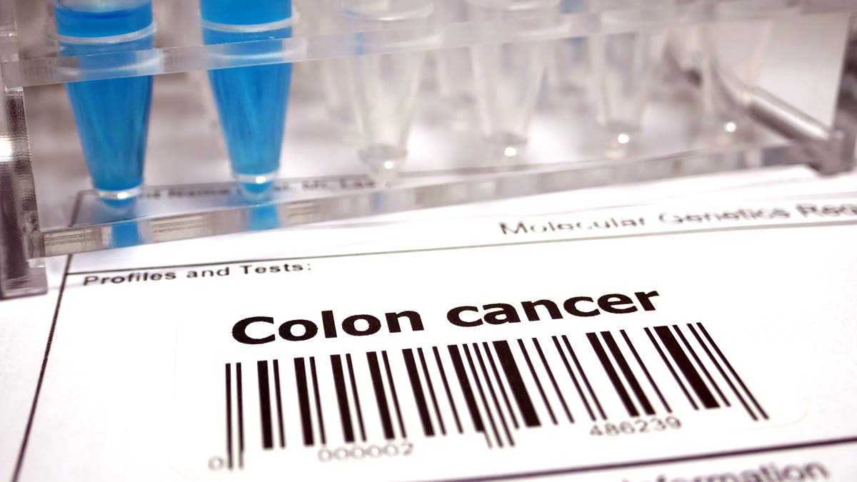 stool-test-for-colon-cancer-screening-ohio-state-health-discovery