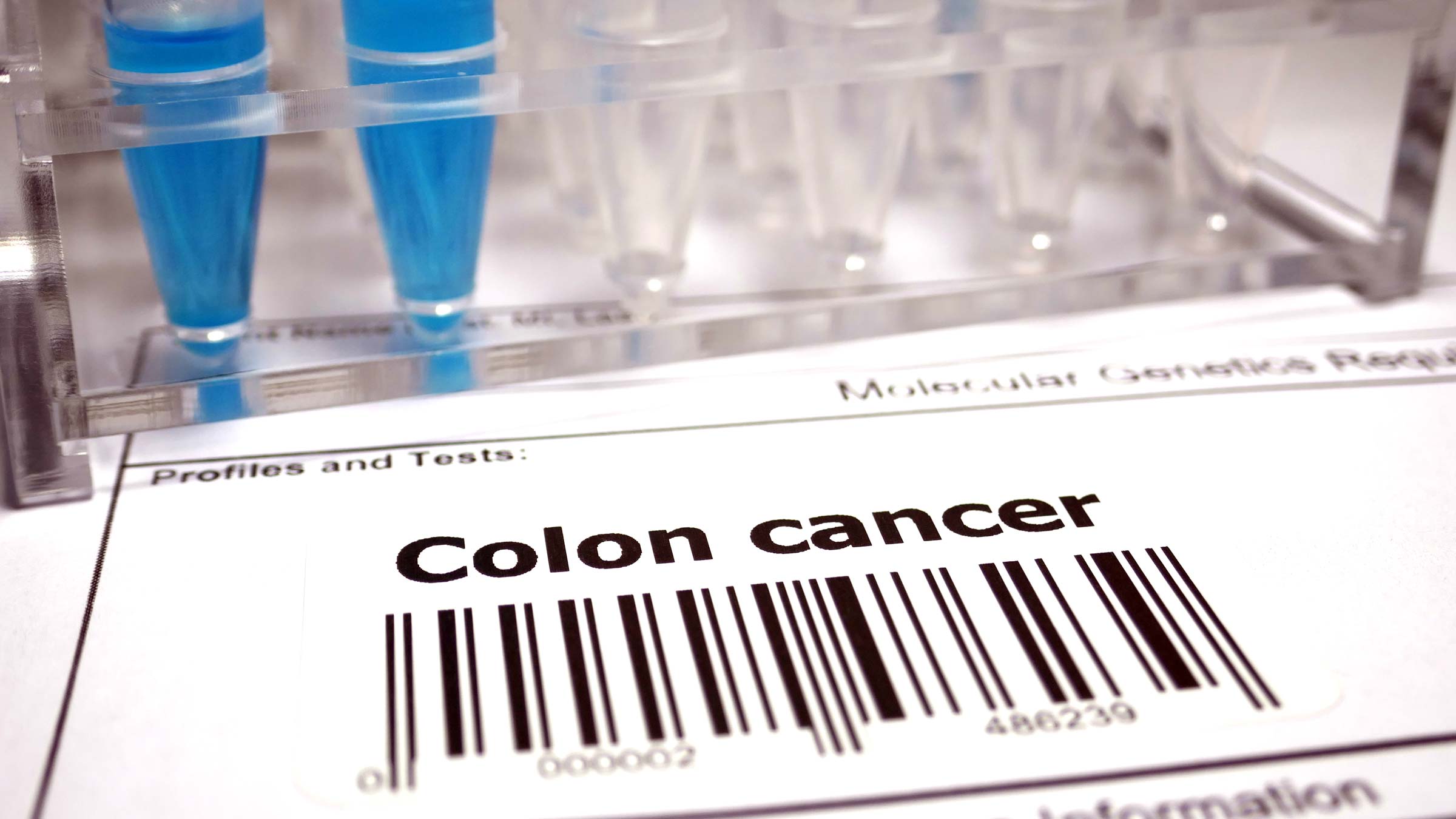What to know about at-home stool tests for colon cancer screening