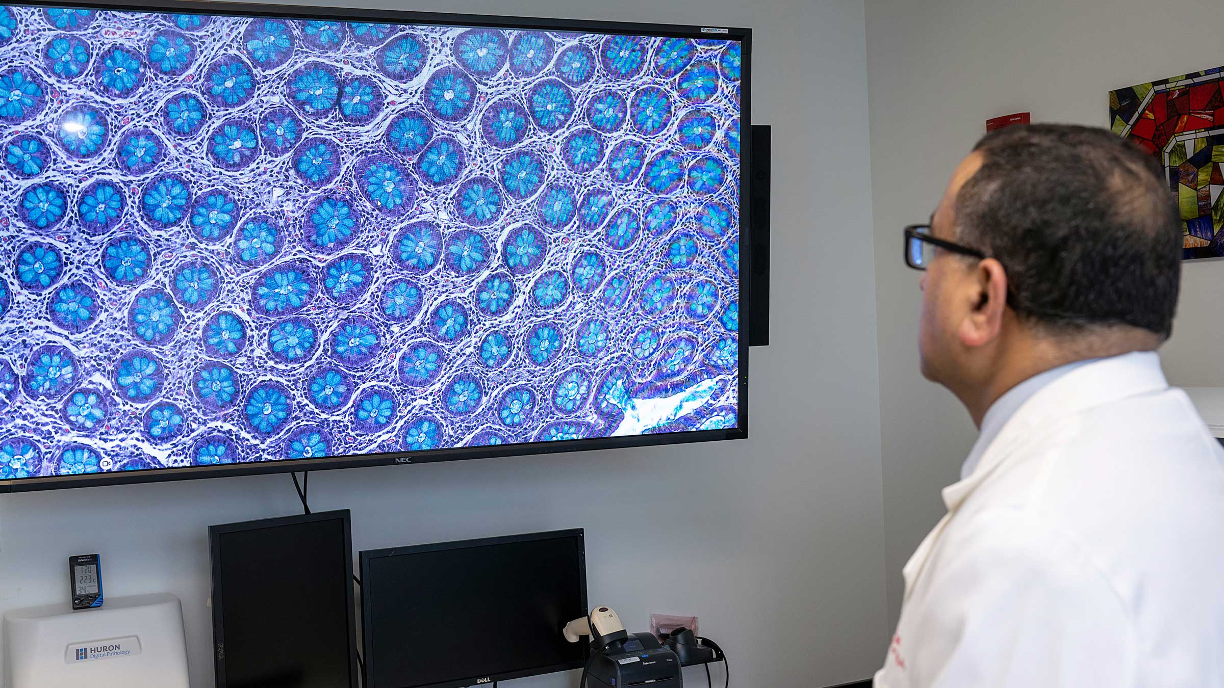 Dr. Anil Parwani reviewing a screen with a microscopic view of cancer cells