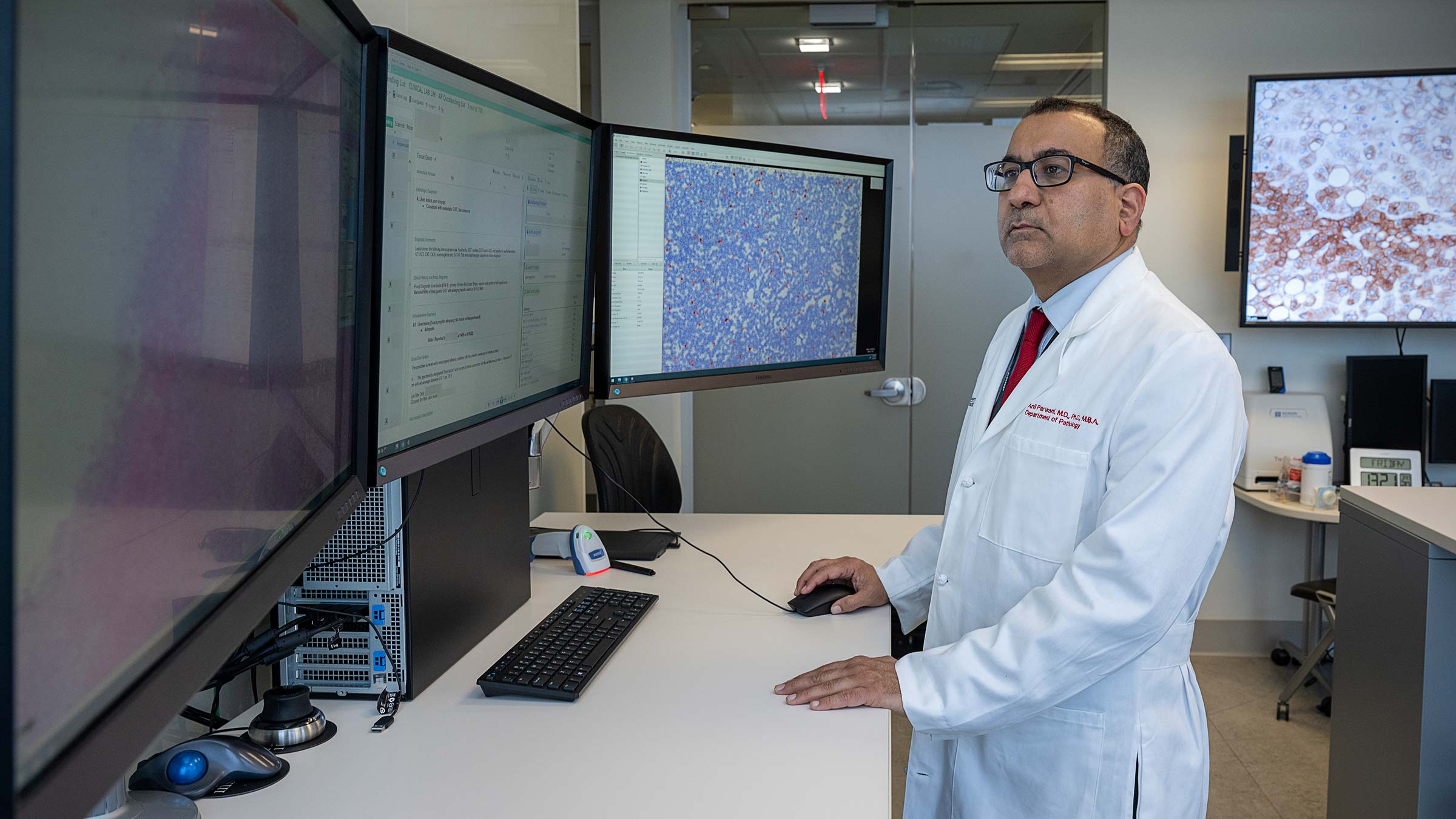 Dr. Anil Parwani reviewing screens with a microscopic view of cancer cells