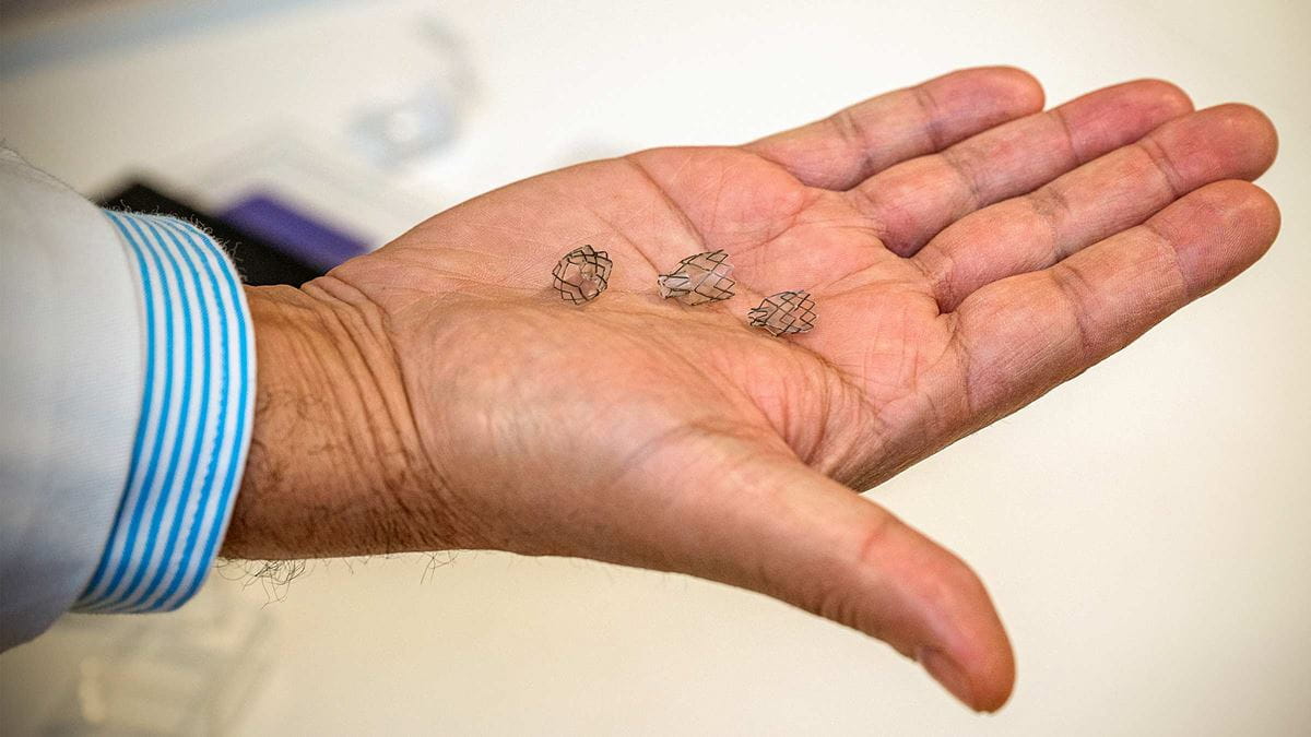 The minimally invasive BLVR procedure involves placing these tiny caged valves in the small airways of diseased lungs.