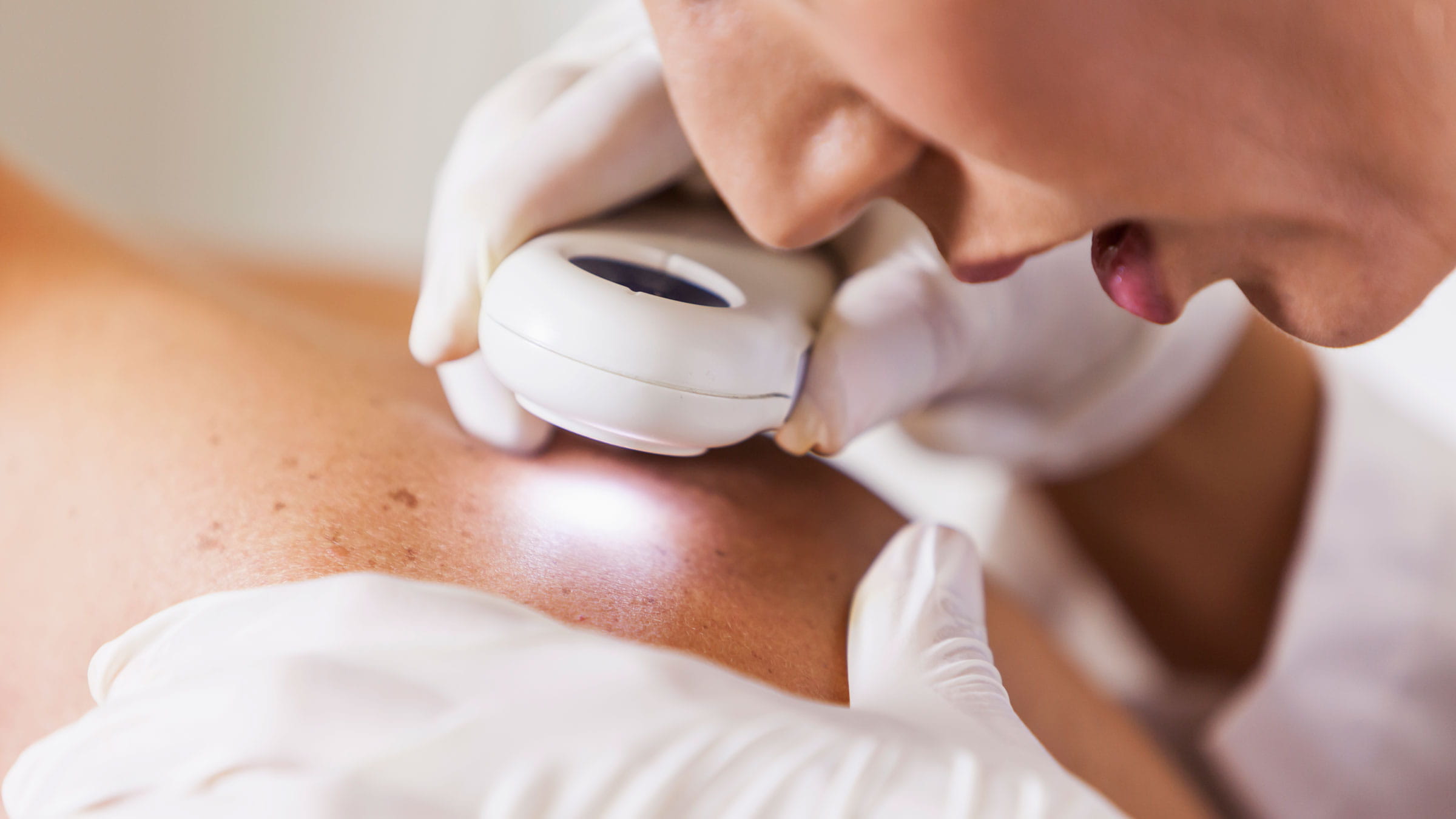 A dermatologist closely examines the skin of a patient's shoulders
