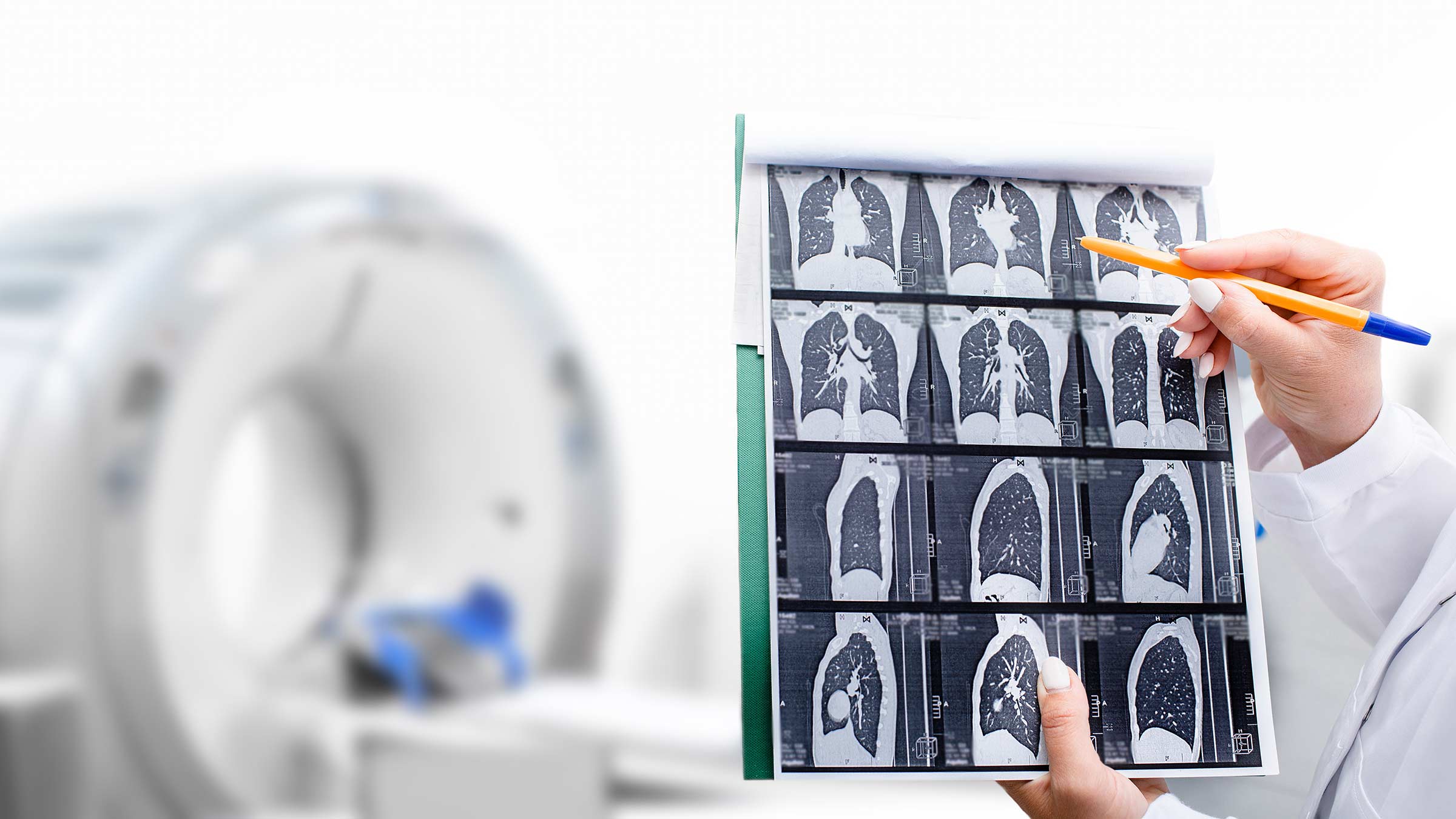 Doctor showing CT scan resultsv