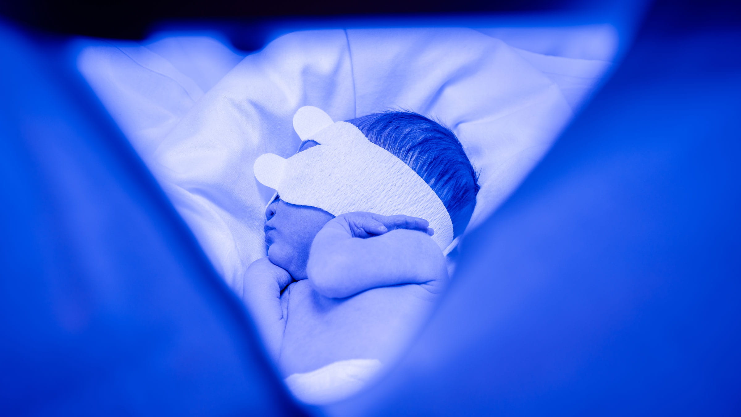Newborn baby undergoing light therapy for jaundice