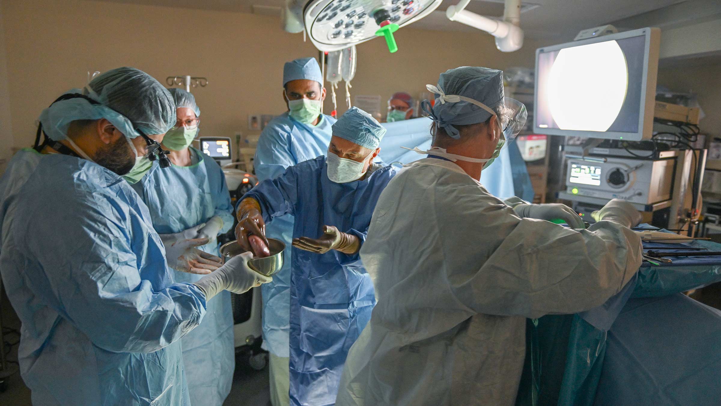 Dr. Amer Rajab removes a kidney for transplant