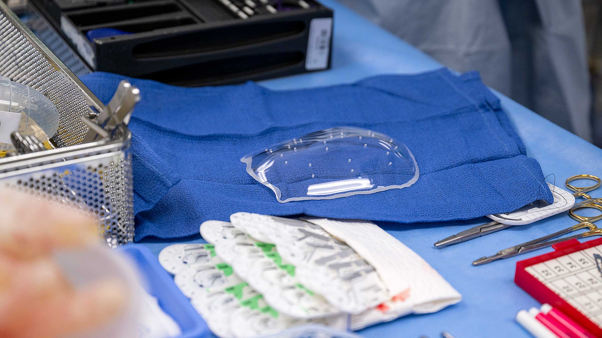 The 3D synthetic implant that will be used in skull reconstruction surgery