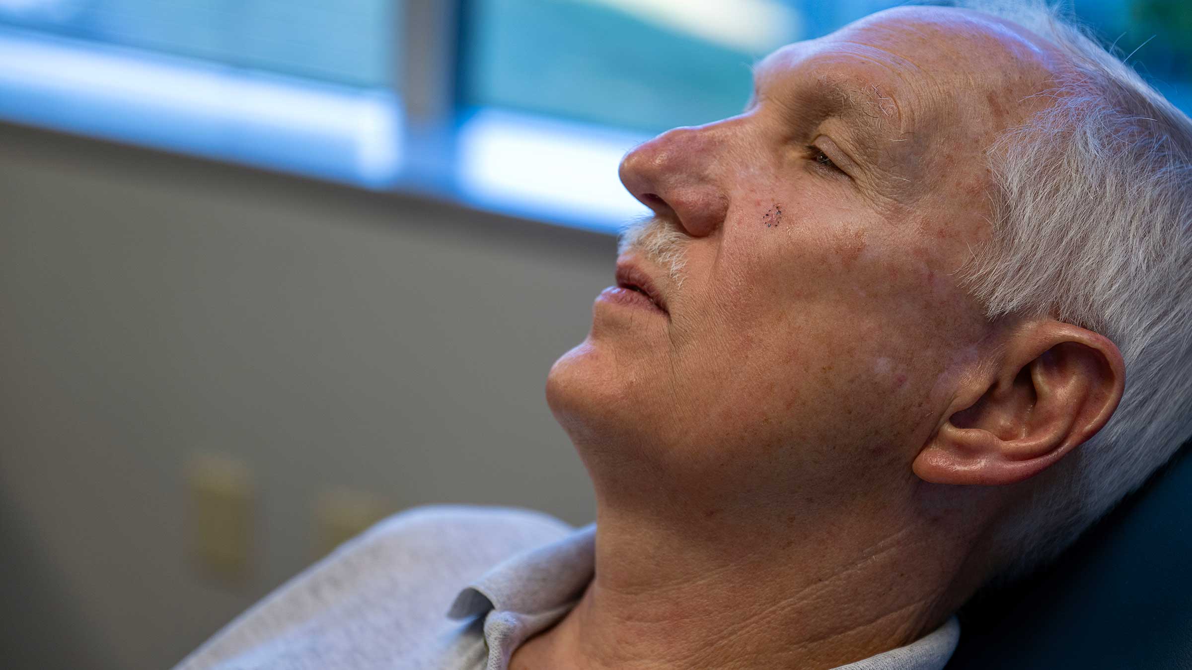 John Komives' face after the procedure