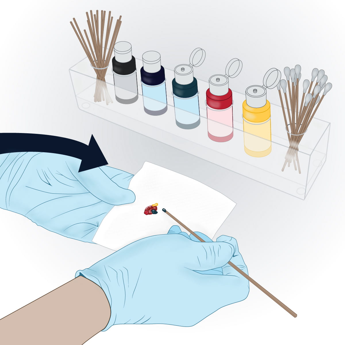 An illustration of a doctor using dyes to mark the lesion