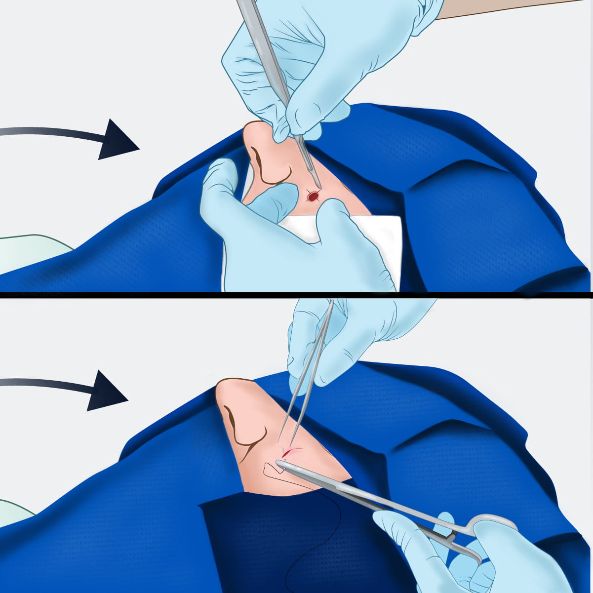 An illustration of a doctor closing up a wound