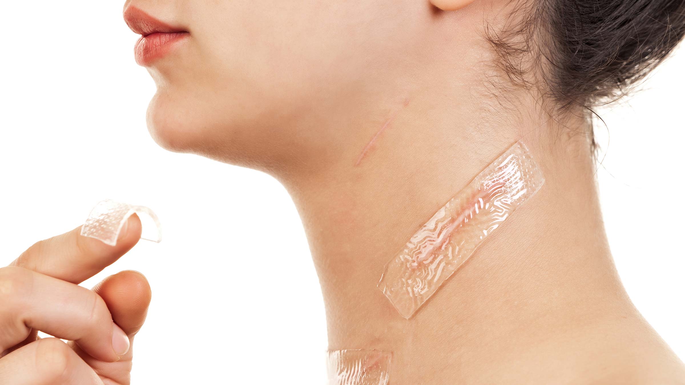 A woman applying gel sheets to scars on her neck