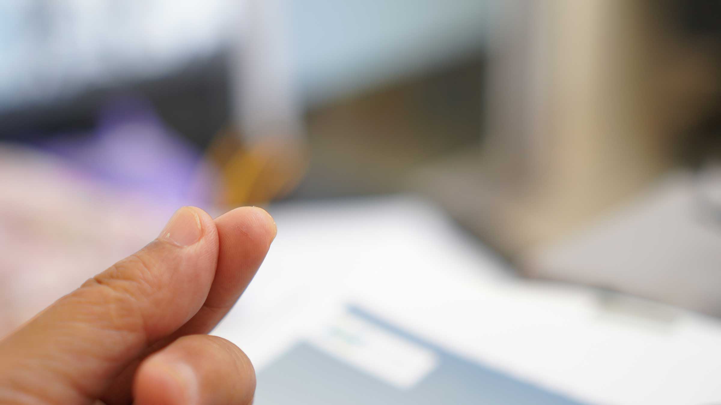 Why do paper cuts hurt so much?