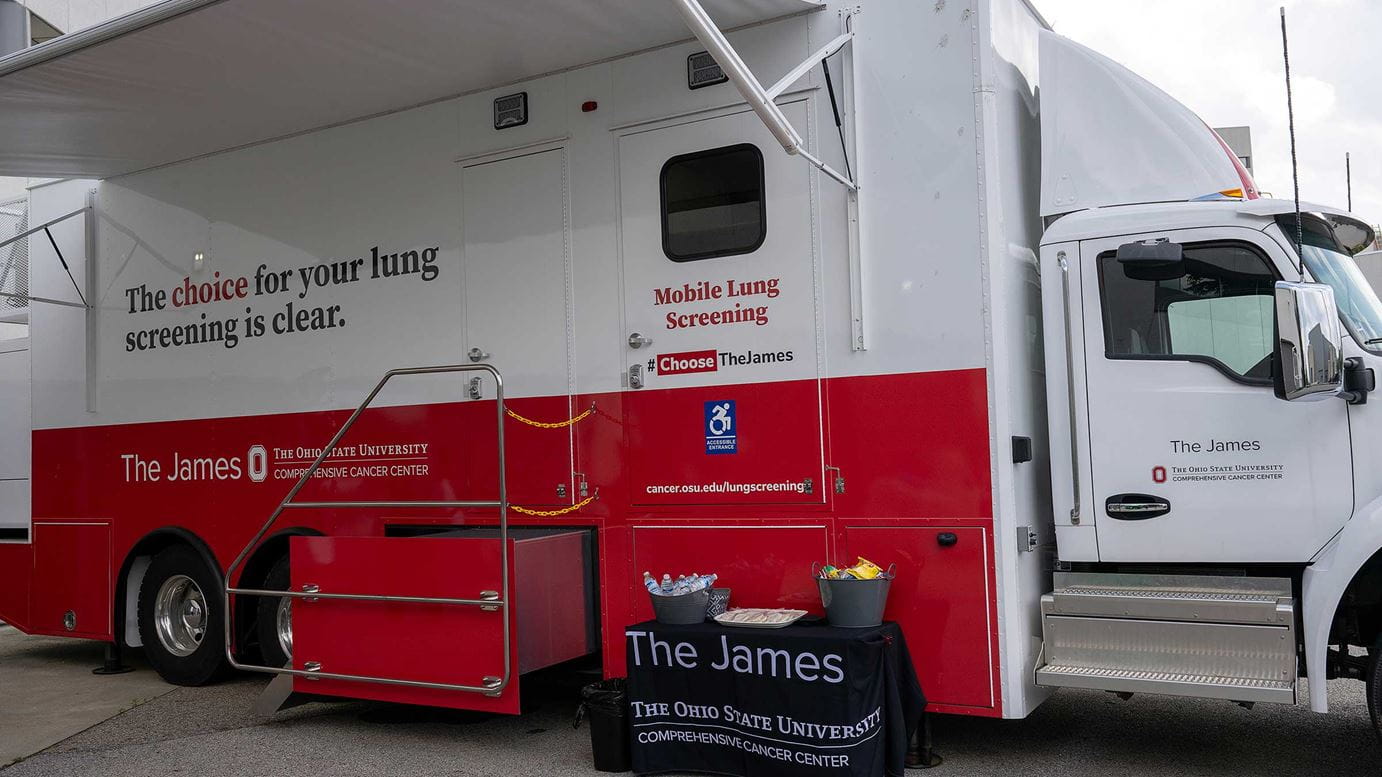 Mobile lung cancer screening unit with the slogan “The choice for your lung screening is clear”