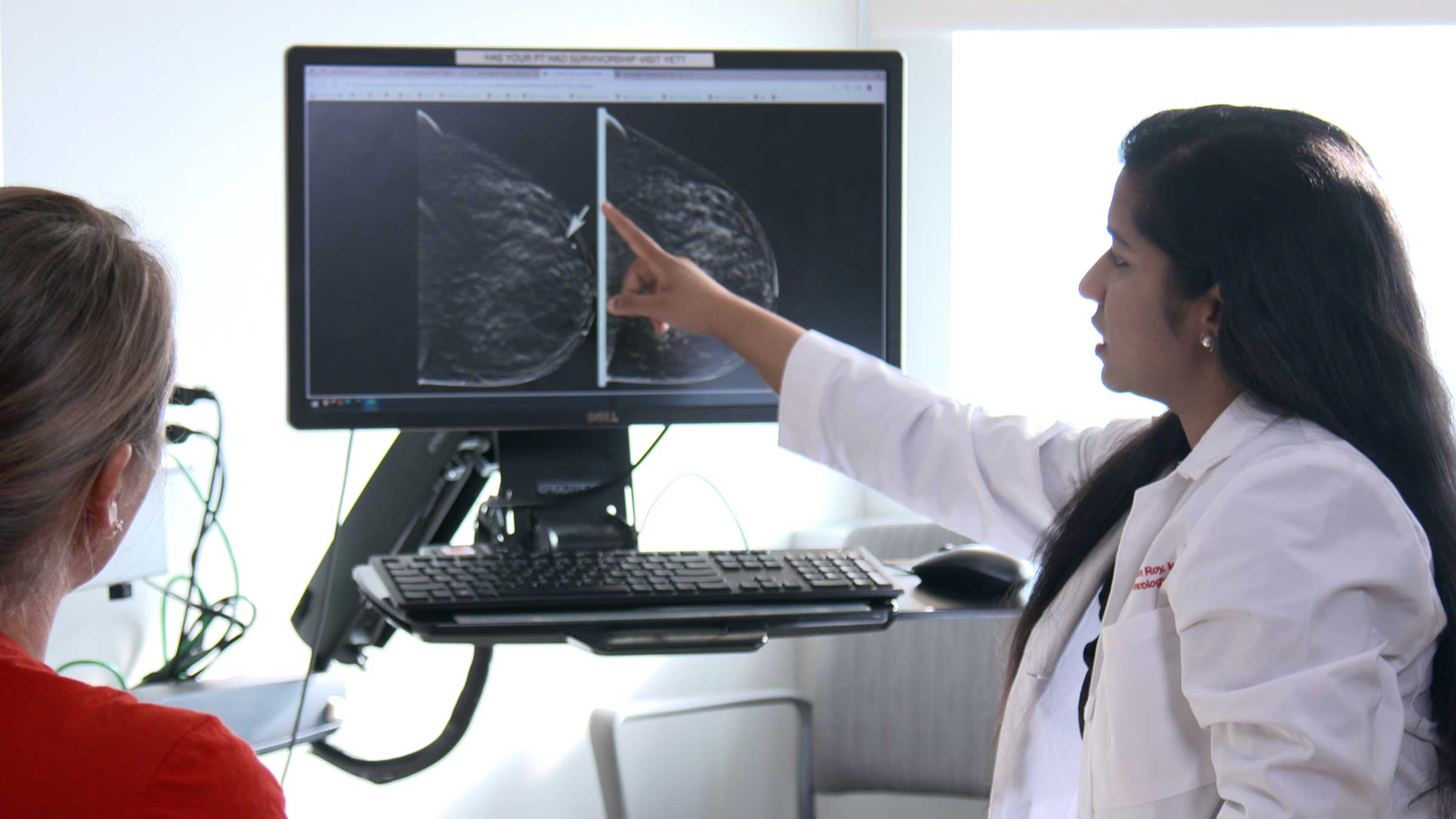 How AI is helping us find lobular breast cancer earlier, giving better treatment options
