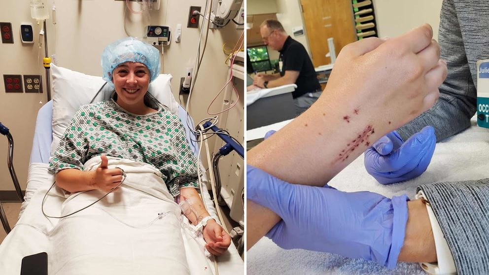 Stegemann in a hospital bed giving a thumbs-up (left), a close-up of a stitched wrist during occupational therapy (right)