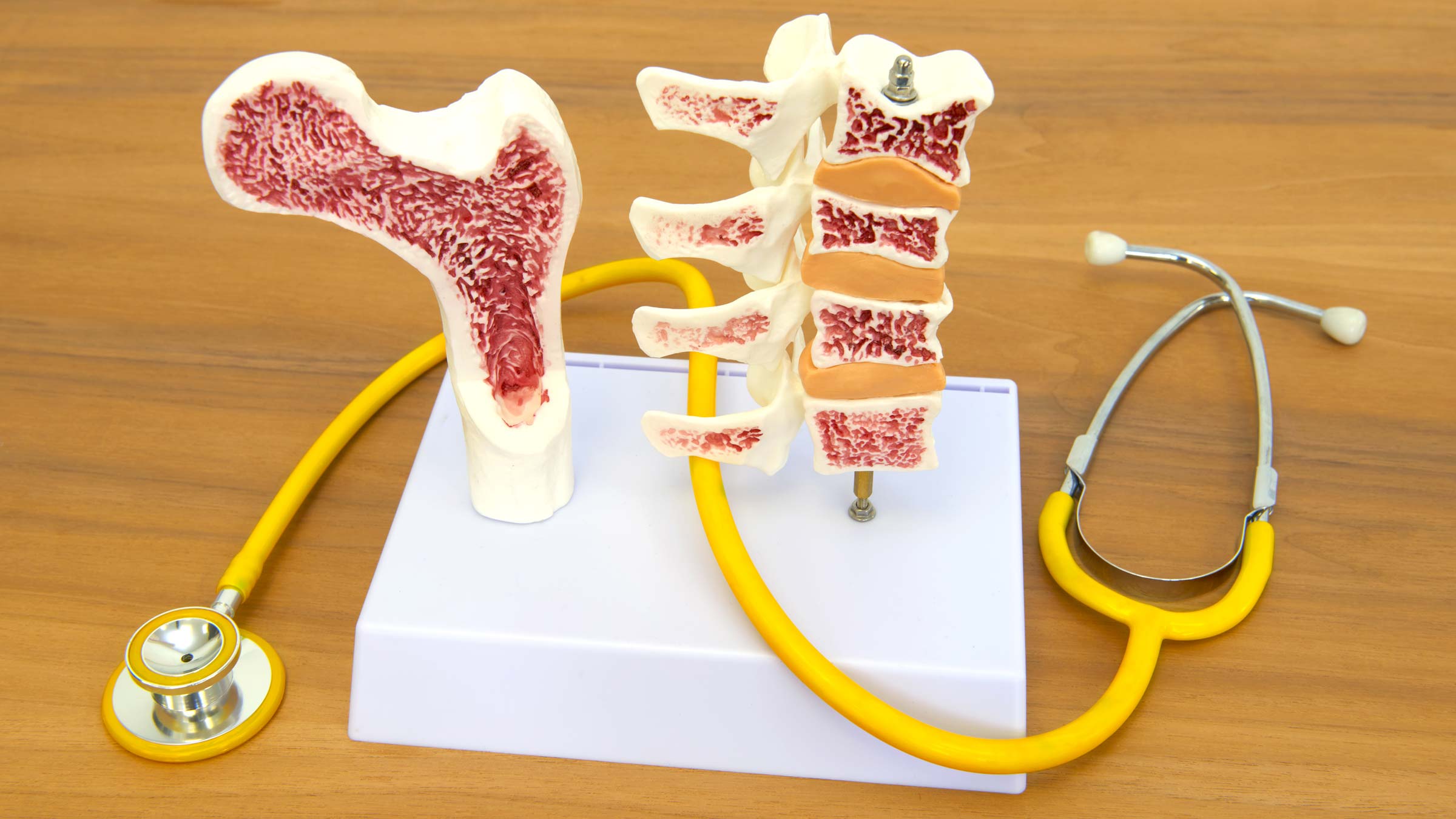 A cross section model of a bone showing bone marrow inside