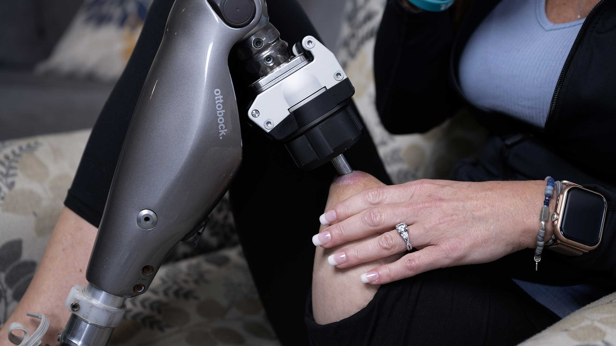 Stacey Finley showing her prosthetic bent at the knee