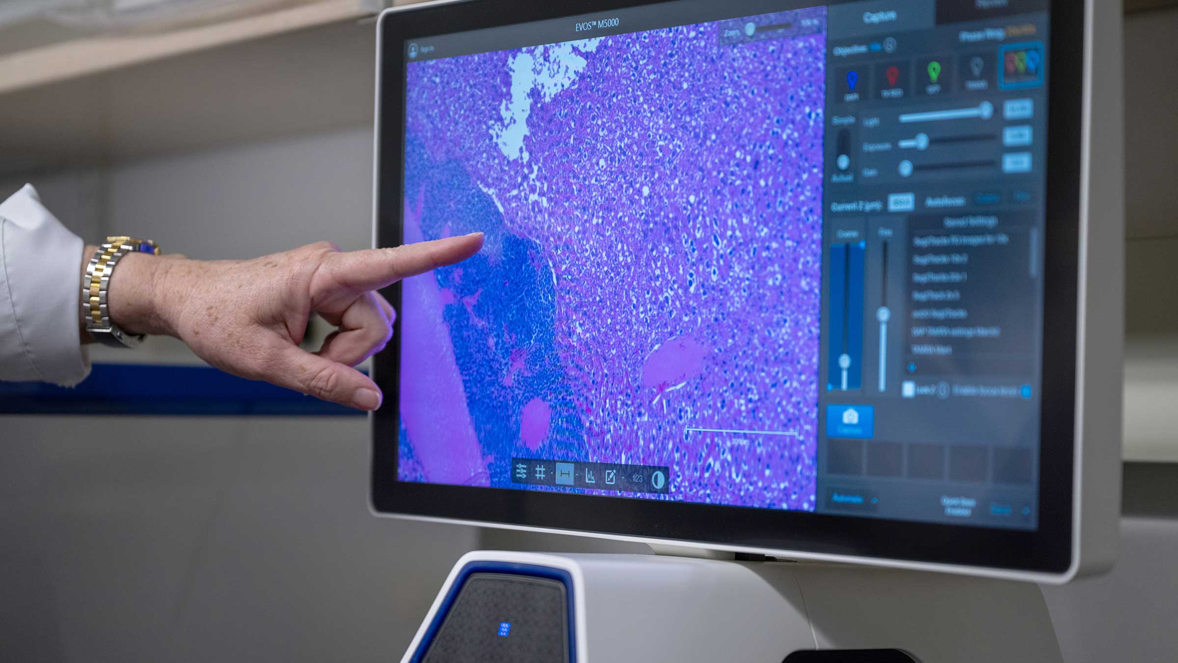 Dr. Chandler pointing to an image of inflammatory cells on a computer screen