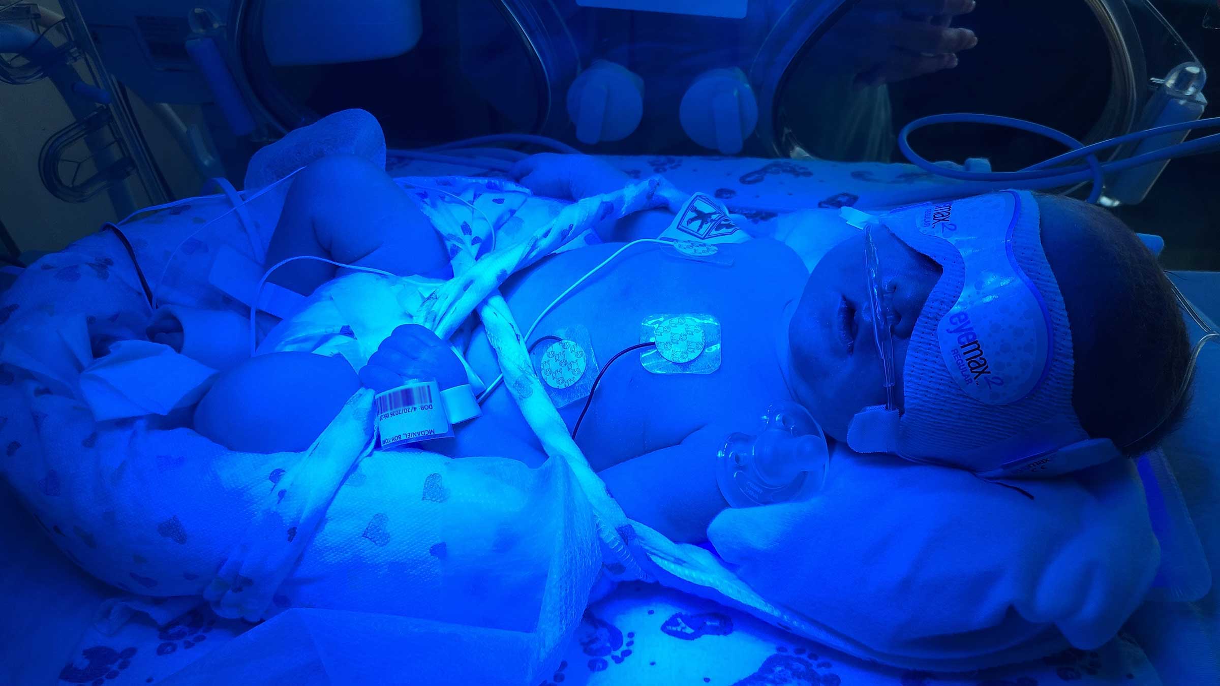 Isaiah sleeping under blue lights in the NICU
